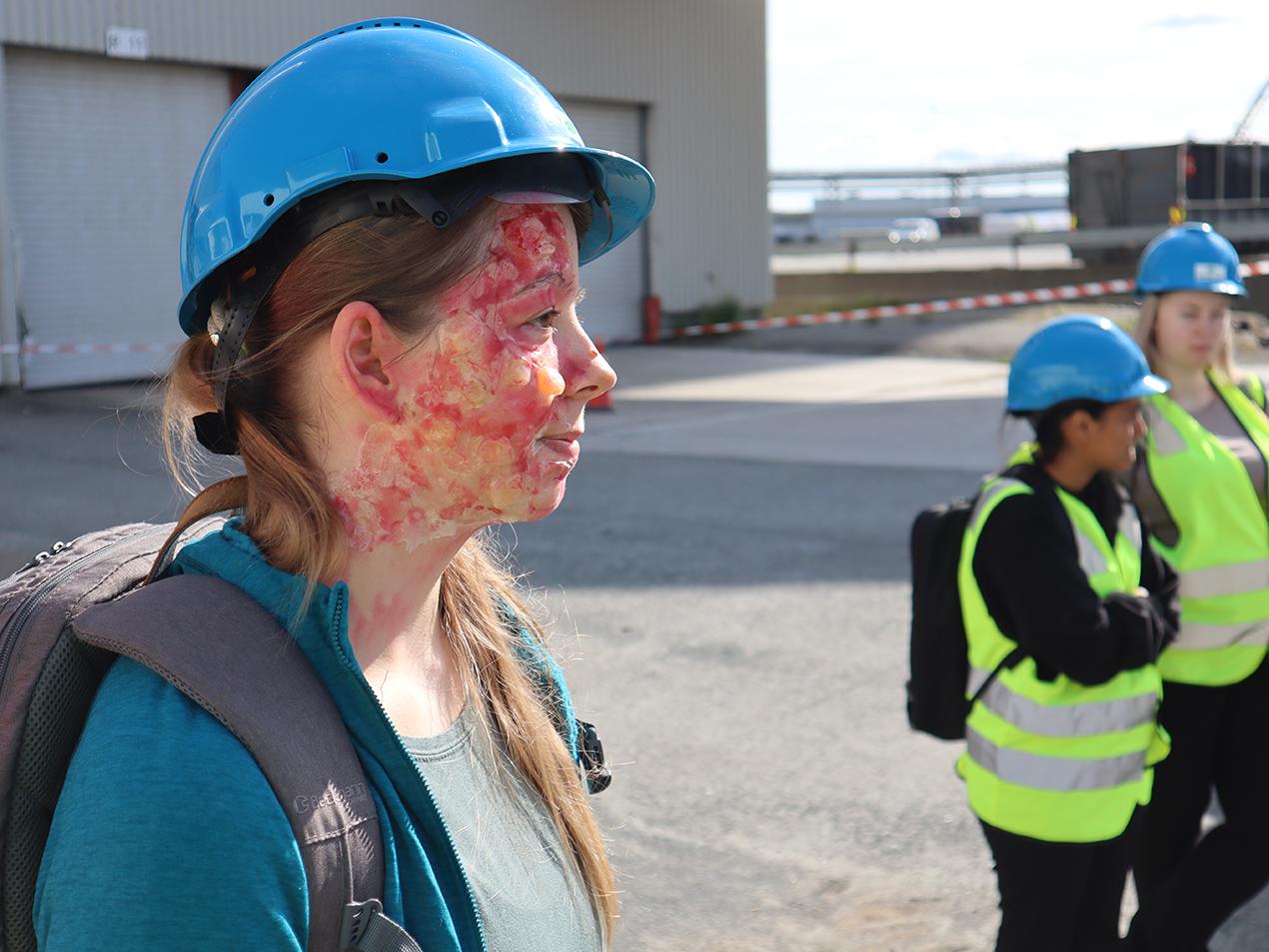 Kvinne med blå hjem, sminket med brannskader i ansiktet